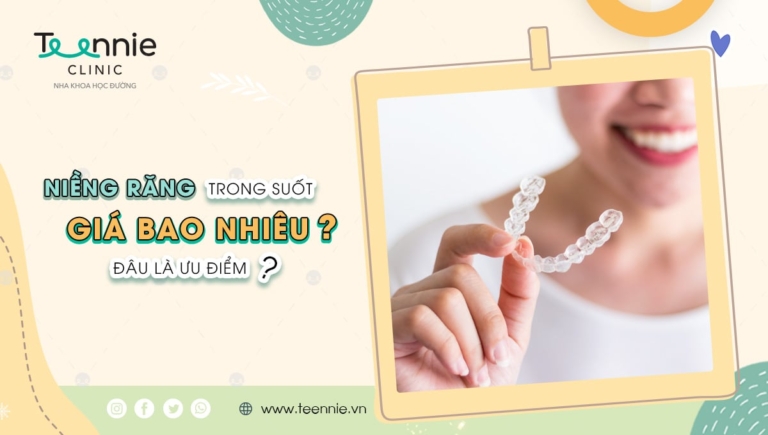 Niềng răng trong suốt giá bao nhiêu? Đâu là ưu điểm?