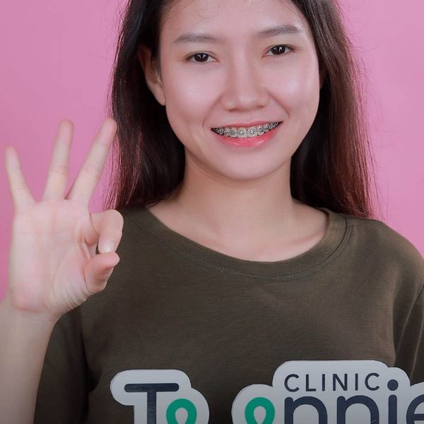 Tác dụng của miếng bảo vệ răng miệng
