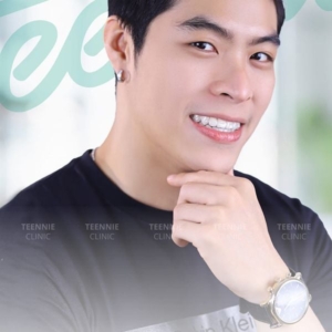 Tại sao cần cạo vôi răng dưới nướu răng