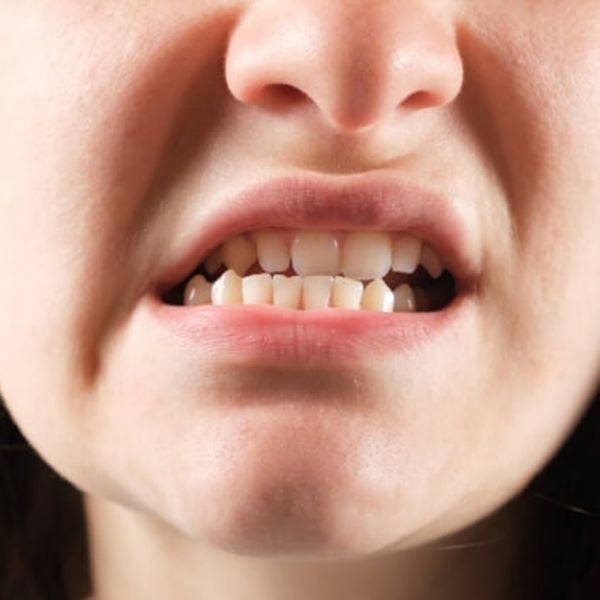 Tình trạng lệch khớp cắn gây hại như thế nào?