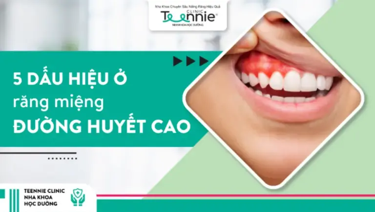 5 dấu hiệu ở răng miệng cảnh báo đường huyết cao