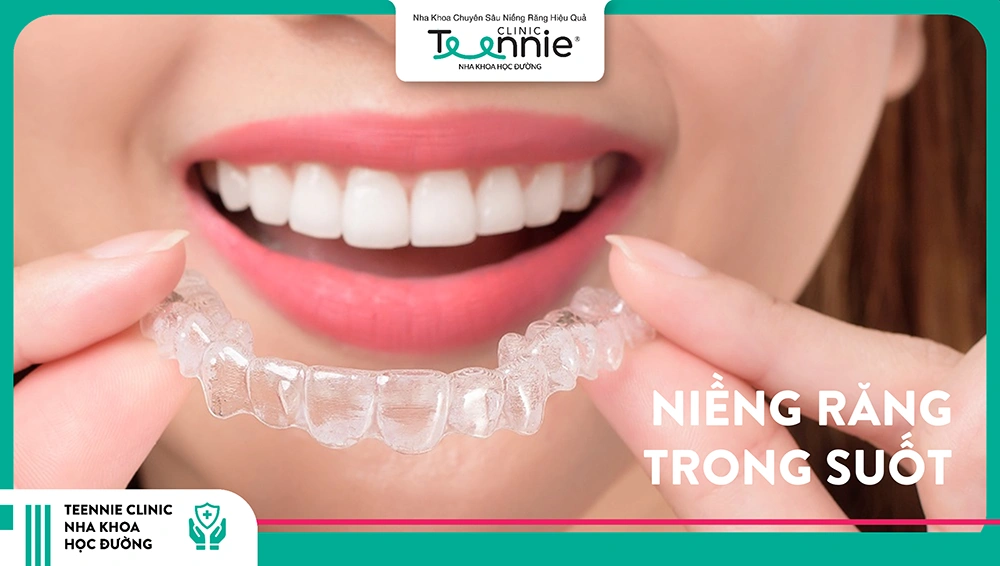 Niềng răng trong suốt
