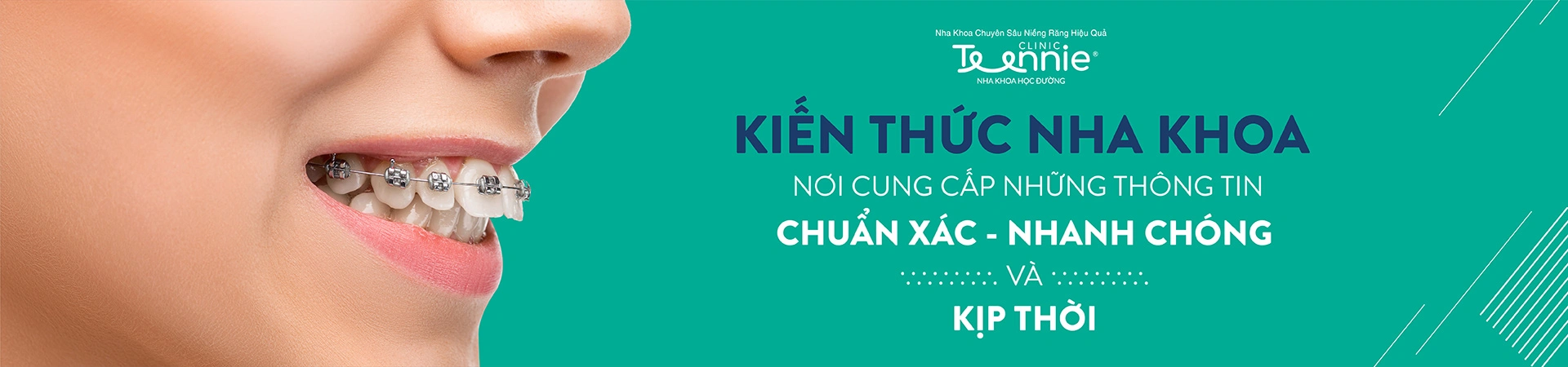 Kiến thức nha khoa