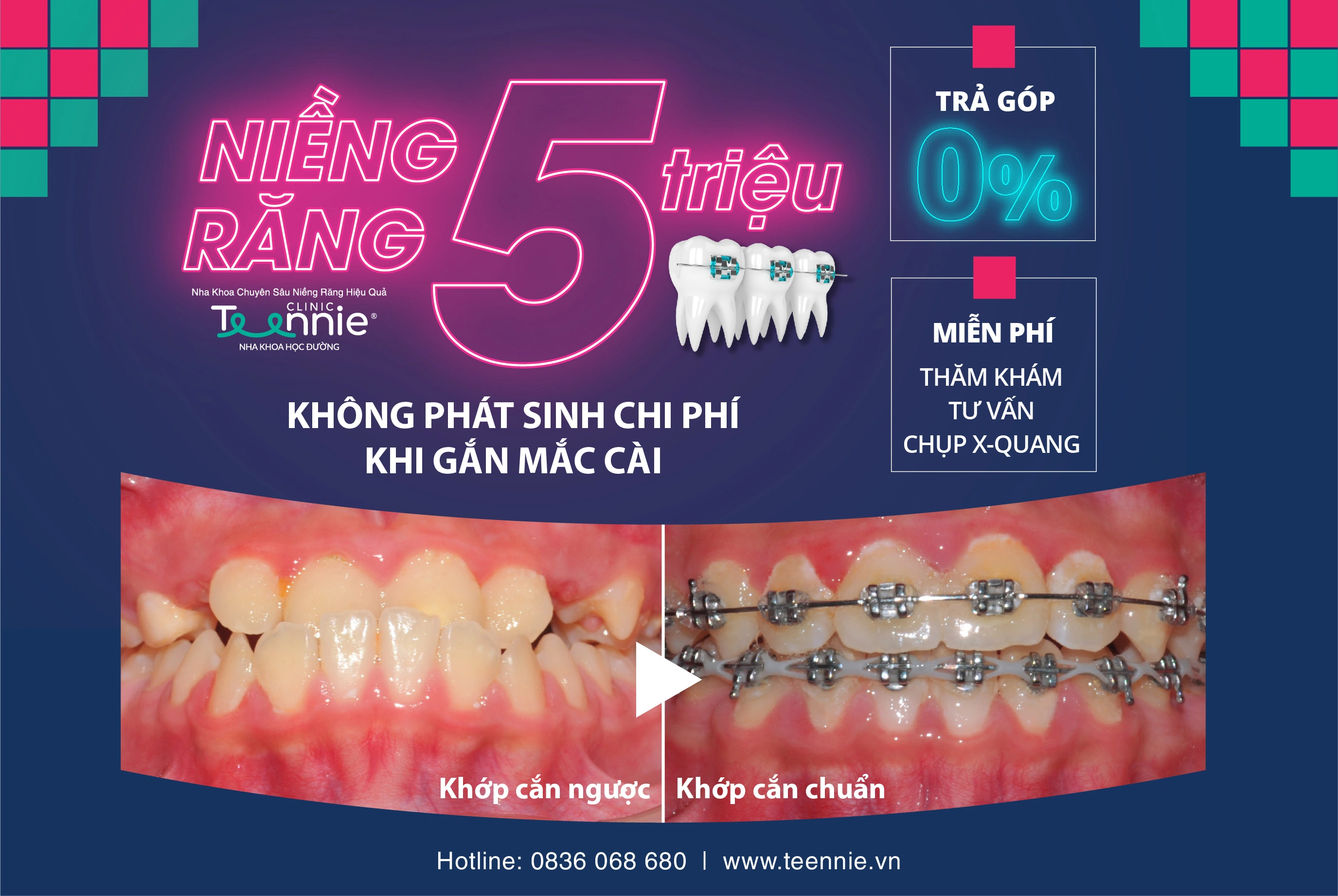 gioi-thieu-trang-chu-03