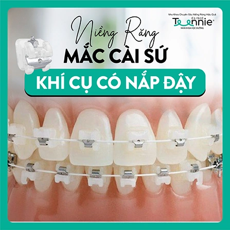 nieng rang mac cai su khi cu co nap day teennie