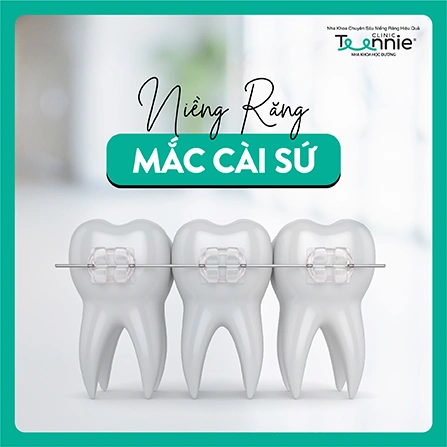 nieng rang mac cai su teennie